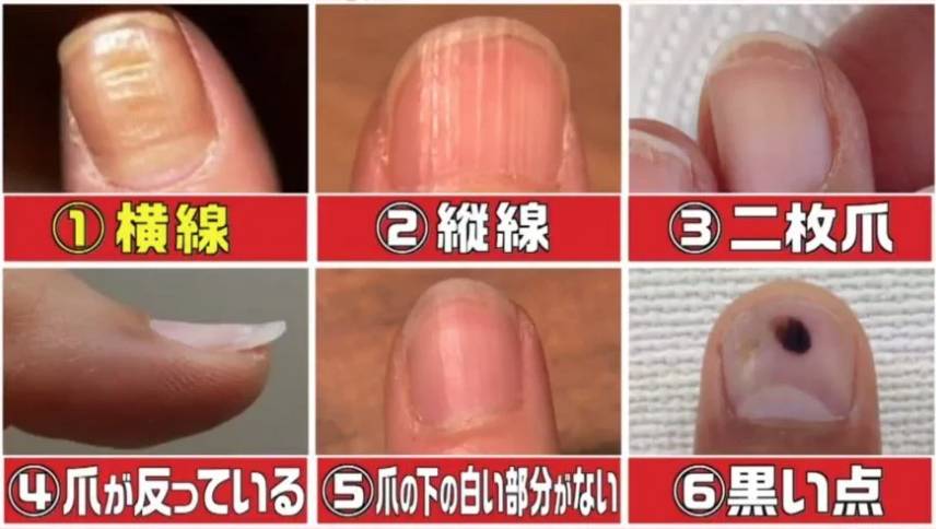 6種不同的指甲。