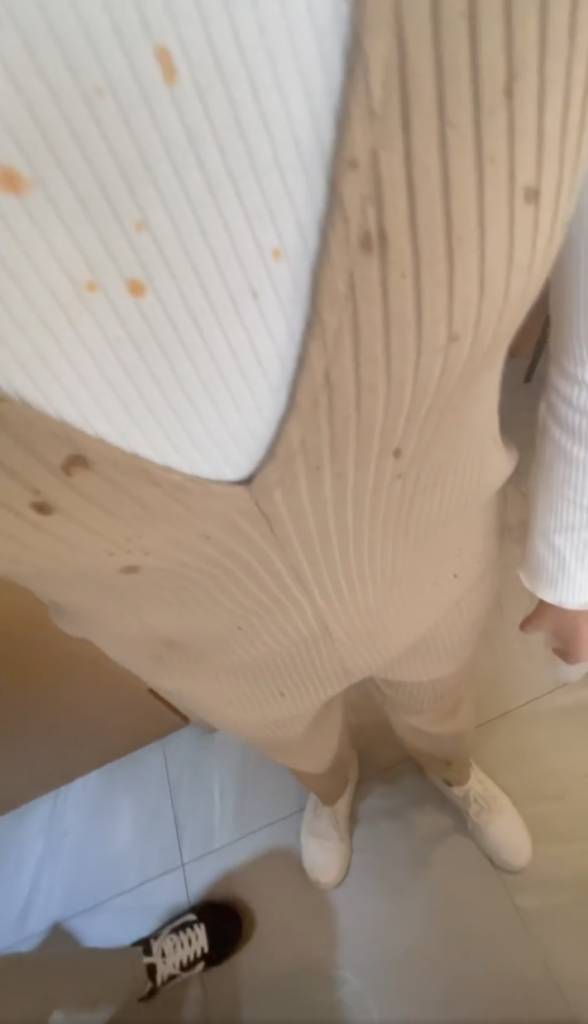 尖沙咀 黑樺牛 事主身上可以明顯見到臉上、衣服及波鞋都有麻辣湯底的痕跡。