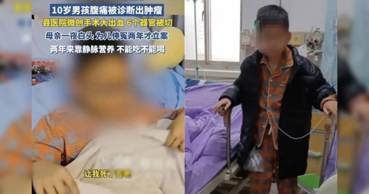 醫療事故 器官切除